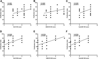 Expression significance of Emi1, UBCH10 and CyclinB1 in esophageal squamous cell carcinoma